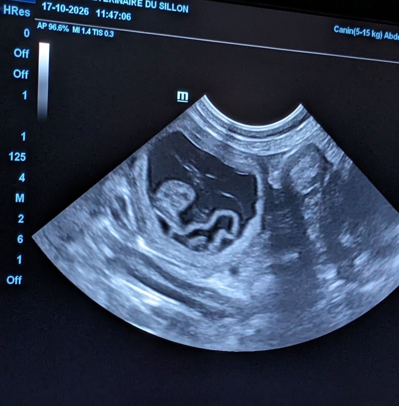 Naissance à venir